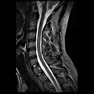 conditions-cervical